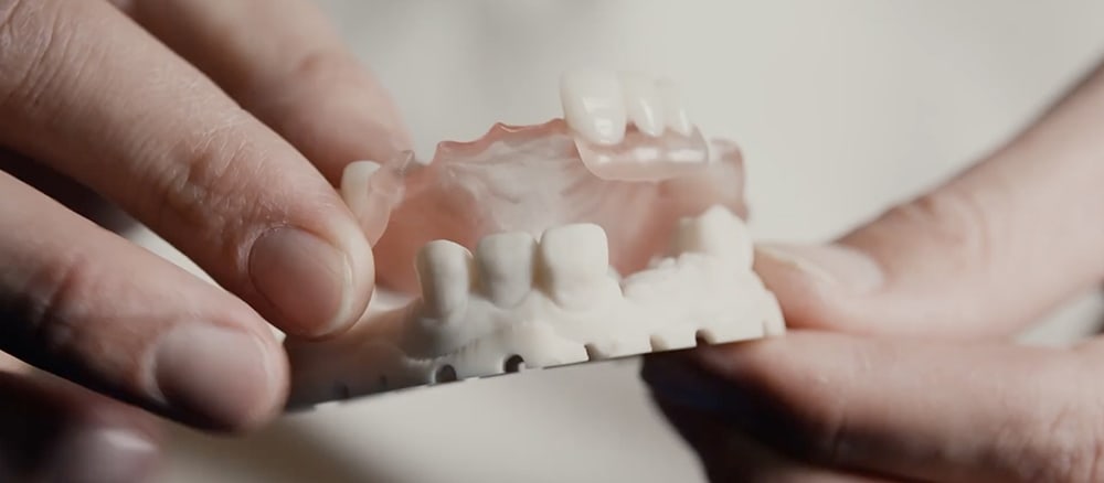 Holding Partial denture