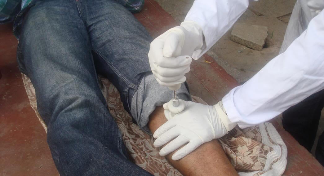 Intraosseous Application.jpg