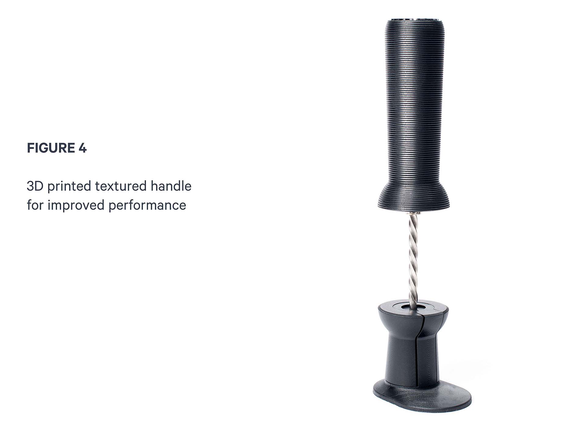 Intraosseous Lunar Figure4.jpg