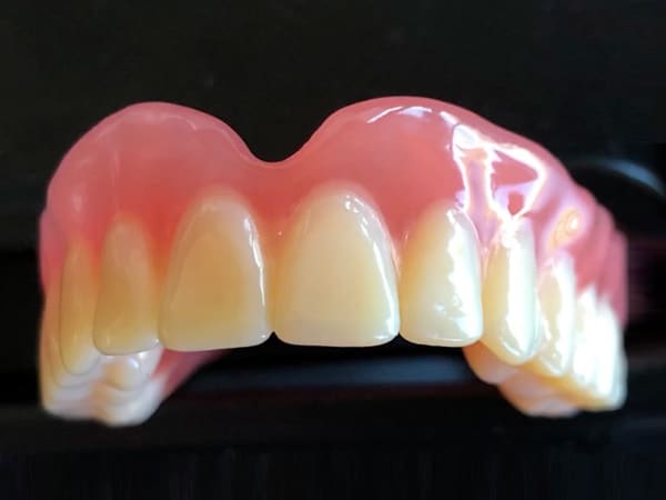 Lucitone IPN digital denture