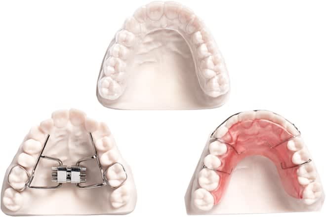 3 Orthodontic Models