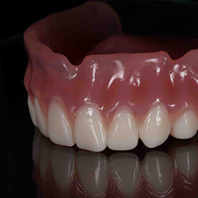 Golden Ceramics dentures