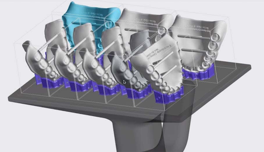 New Denture Software Automation Tool: Reduce Digital Denture Prep Time by 50%