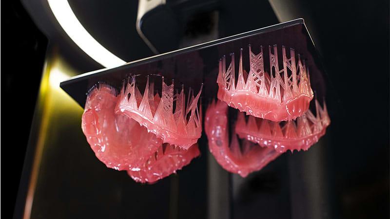 3D Printed Denture Base