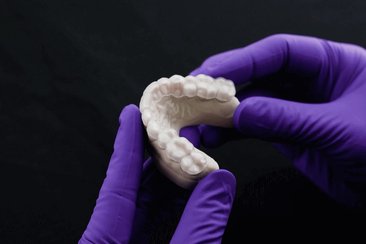 3D Printed Dental Mouth Guard and Mold/Model