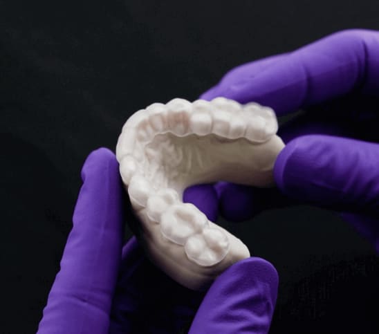 Inspecting Aligner Fit on a Lower Denture