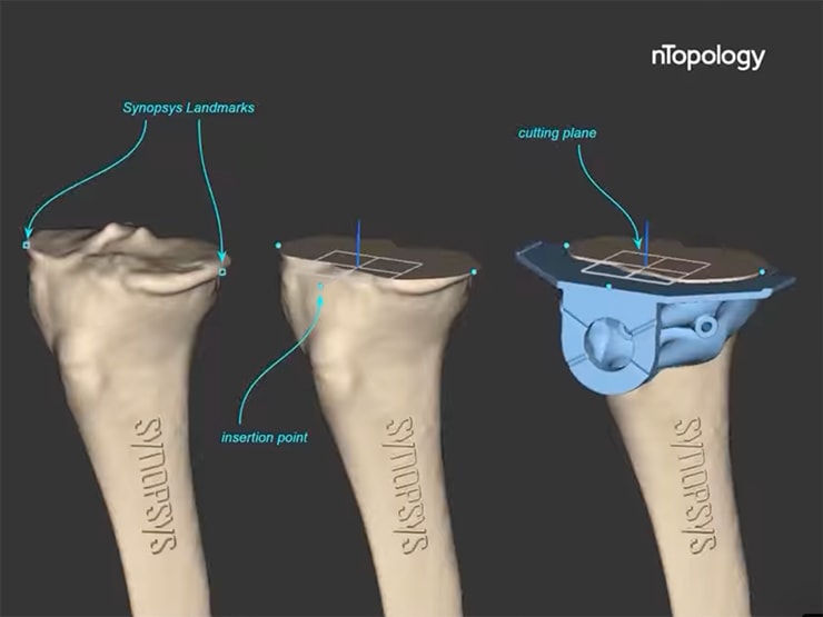 Automated Digital Workflows for Medical Devices