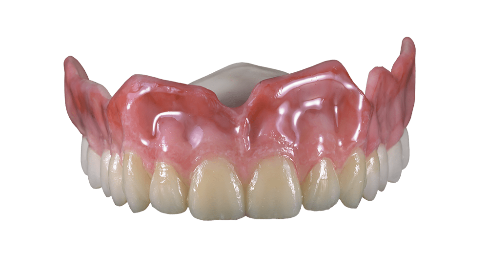 Flexcera Denture