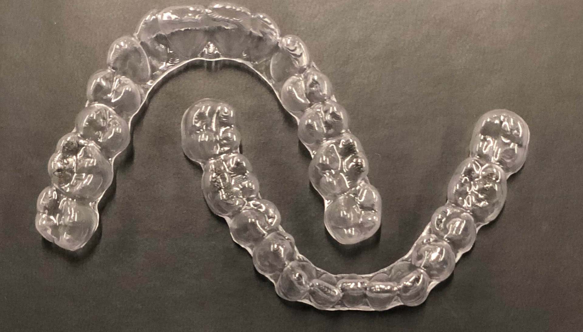 Derby Dental Aligner.jpg