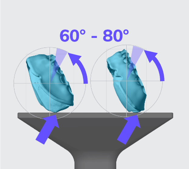 Lower and Upper Denture Bases Orientation Angle Lower and Upper Denture Bases Orientation Angle