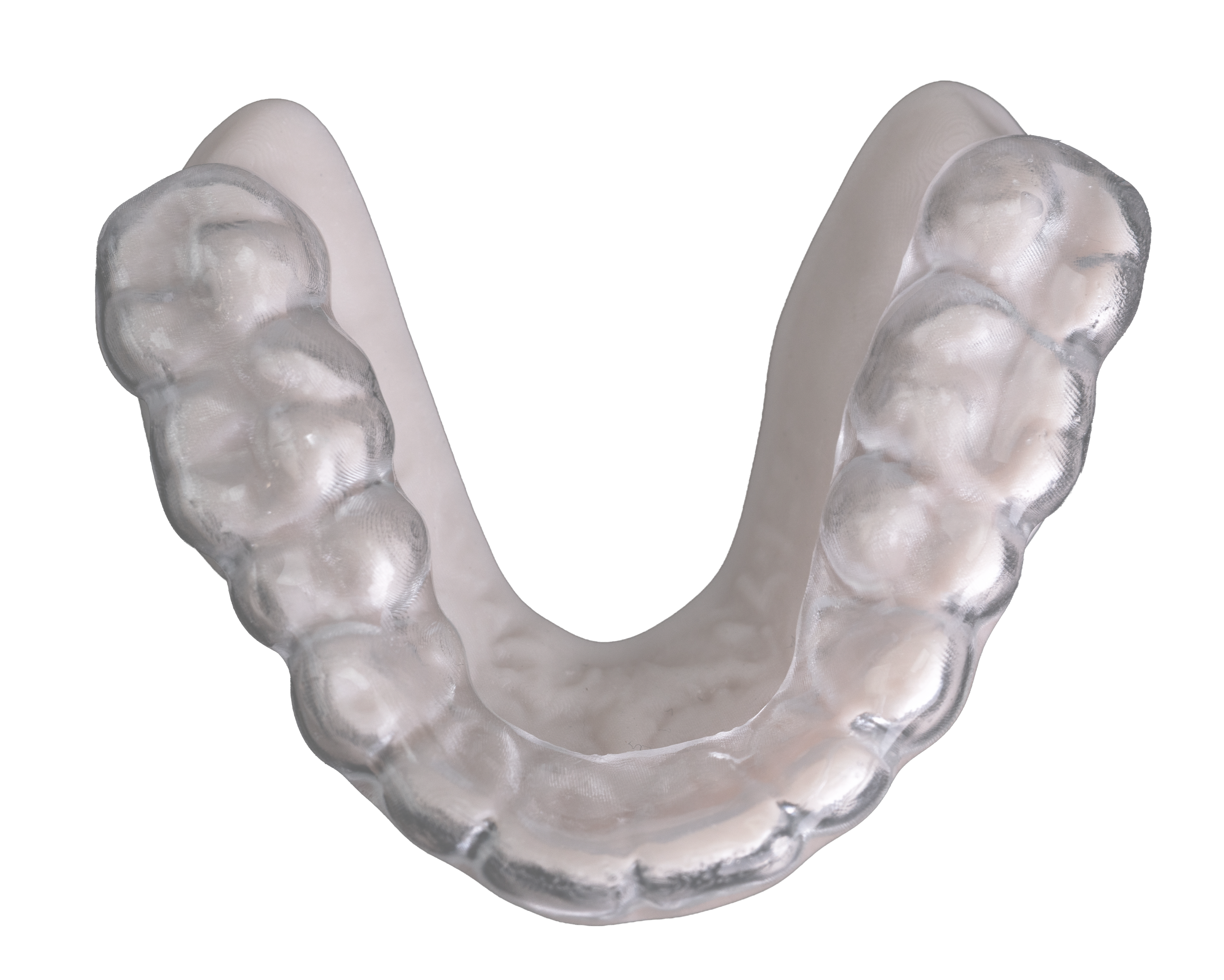 Example Splint