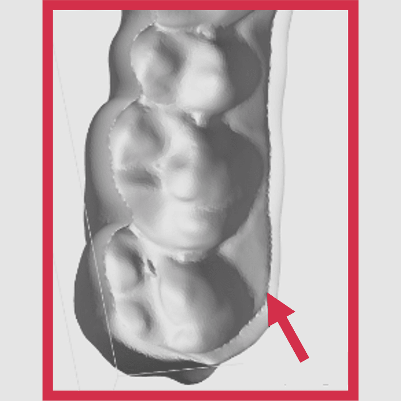 Supports will not connect to a sharp knife edge