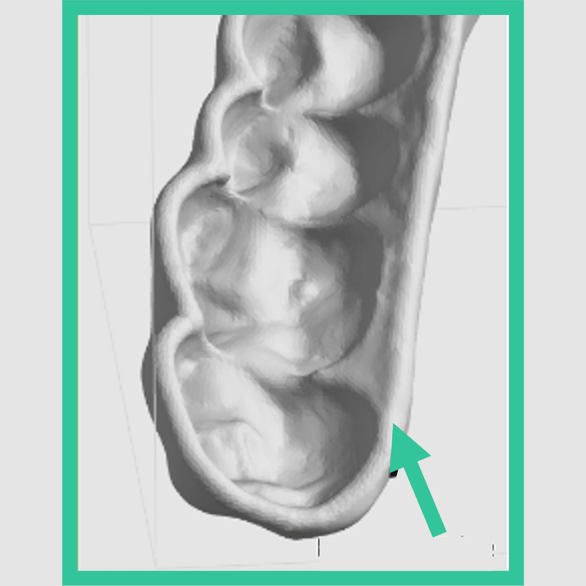 Supports connect well to a round edge