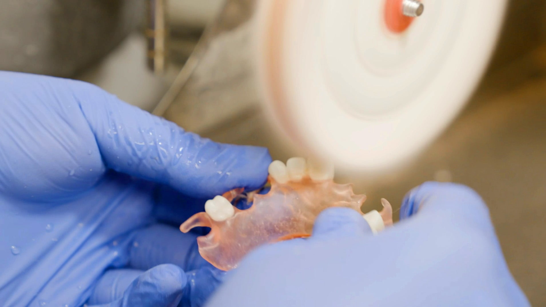 Polishing the bonded denture Polishing the bonded denture