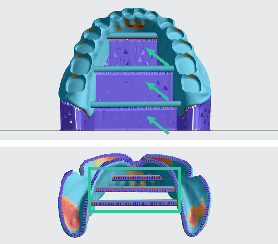 Views from the front and bottom showing supported bars Views from the front and bottom showing supported bars