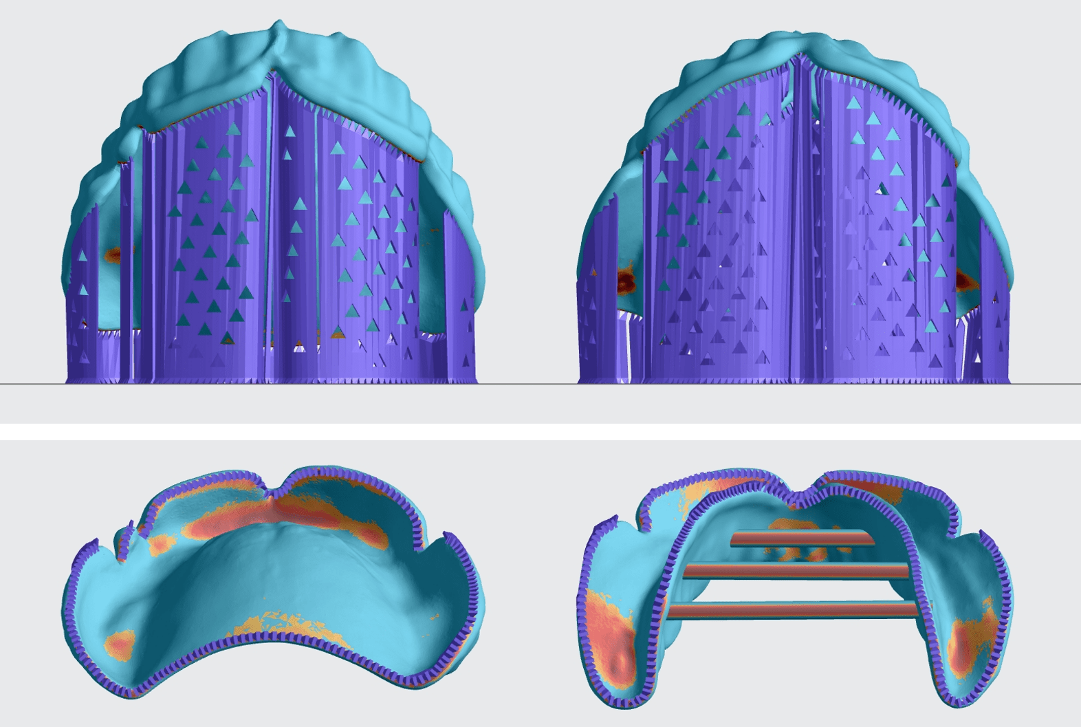 Views from the front and bottom showing supported edges Views from the front and bottom showing supported edges