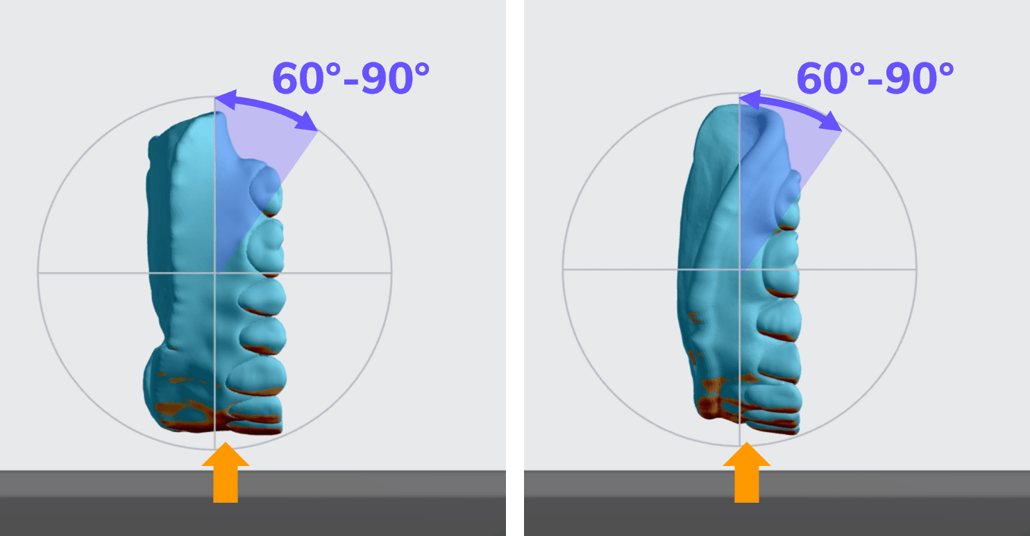 Upper and lower try-in
