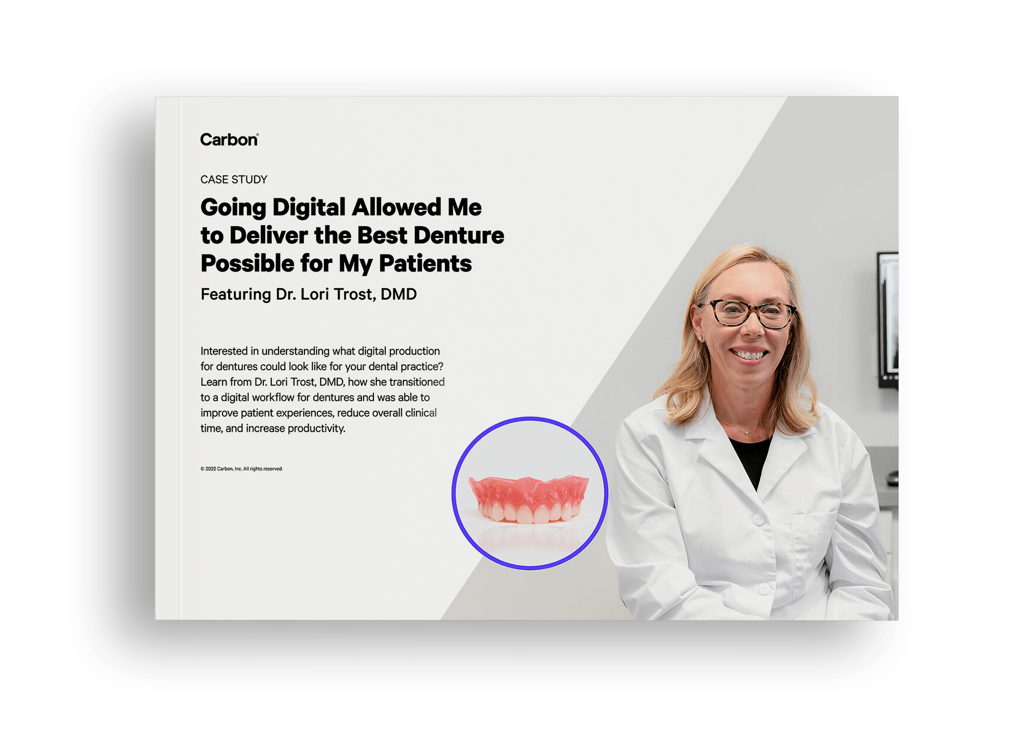 Going Digital Allowed Me to Deliver the Best Denture Possible for My Patients