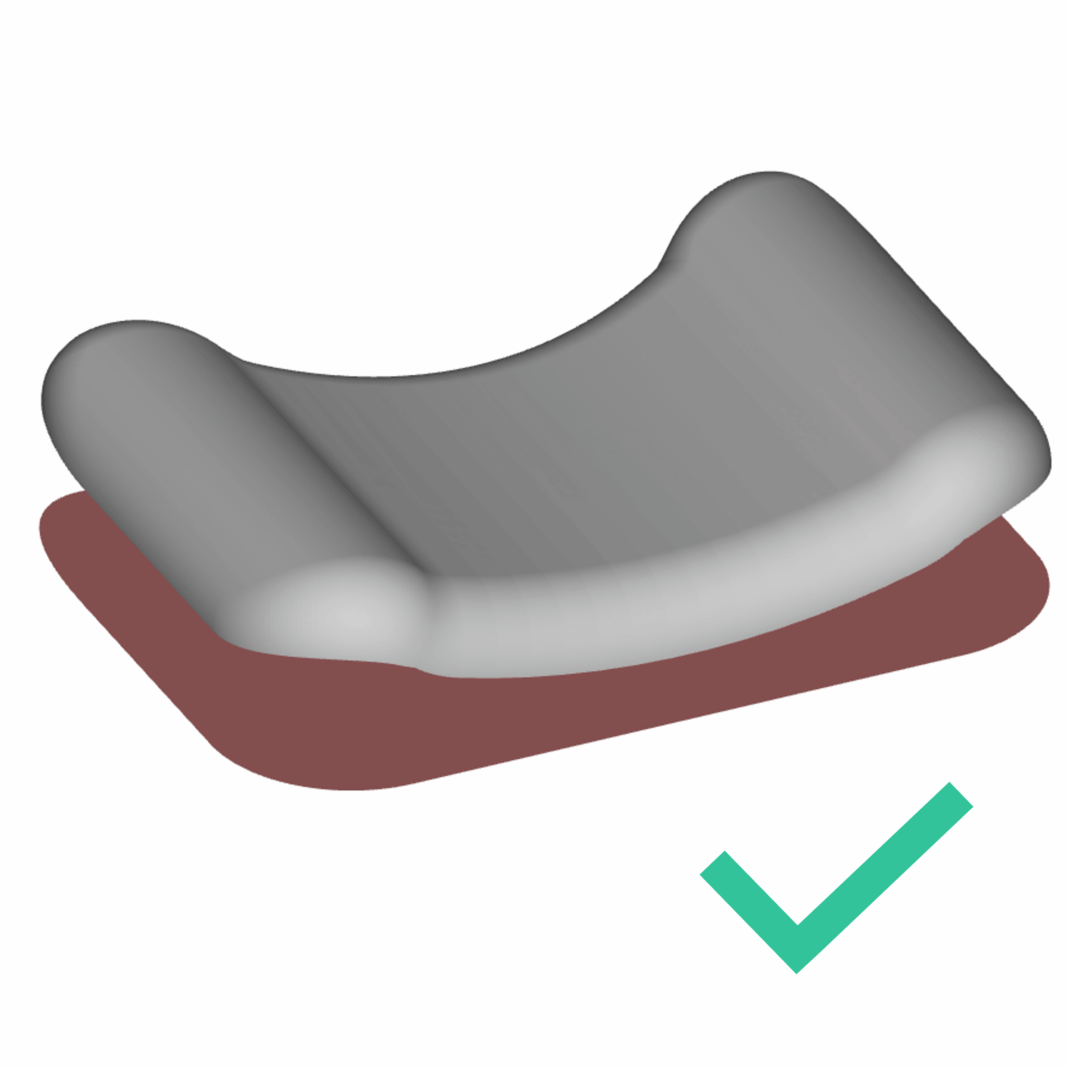 Surface patches cannot intersect. Surface patches cannot intersect.