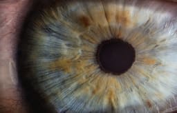Adaptación de lentes para queratocono
