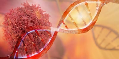 Clinical Experience of Using Integrated Whole Genome and Transcriptome Sequencing as A Framework for Pediatric and Adolescent Acute Myeloid Leukemia Diagnosis and Risk Assessment