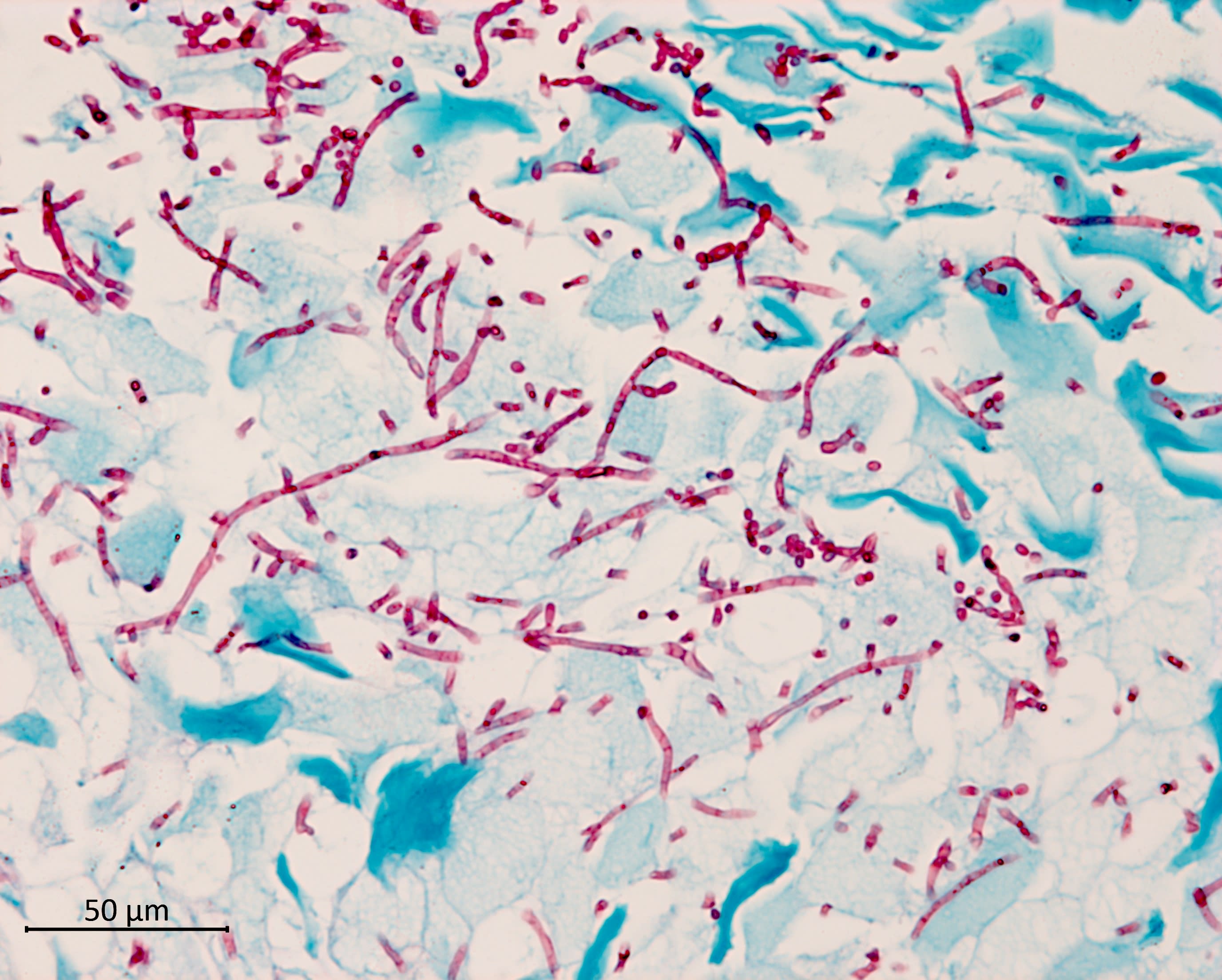 Selected N-substituted benzisoselenazol-3(2H)-ones possess anti-mycotic activity in vitro and in a mouse model of vulvovaginal candidiasis - presented by Prof Blase Billack