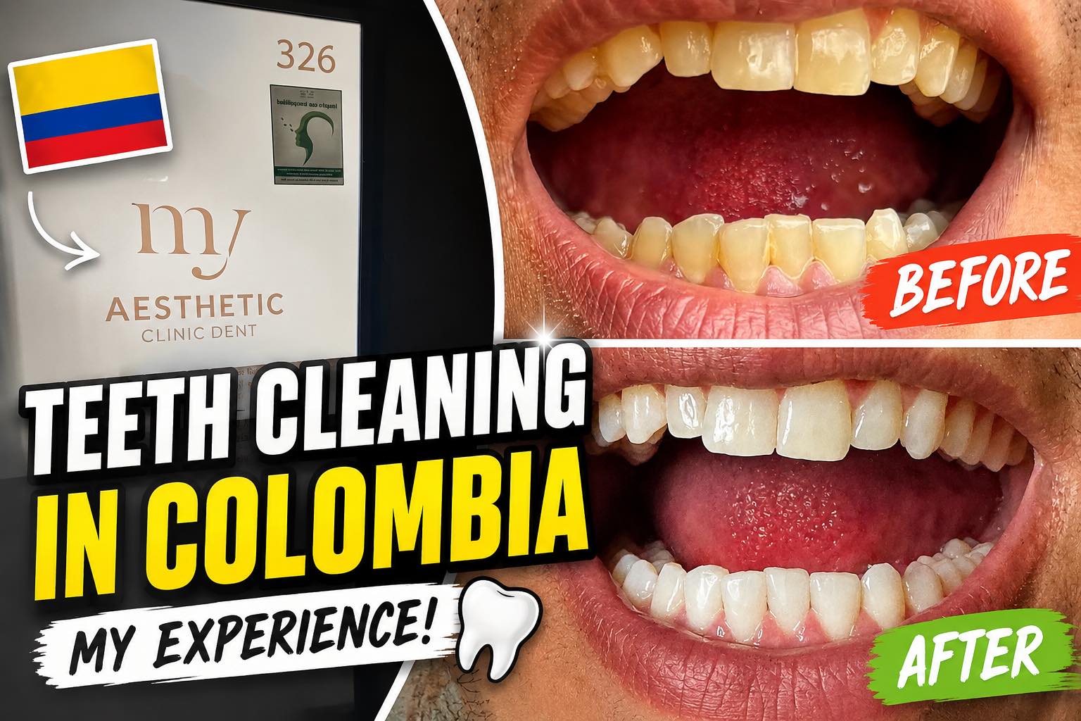 Dental Care: Florida vs Medellín