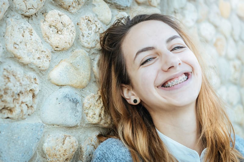 beugel orthodontie