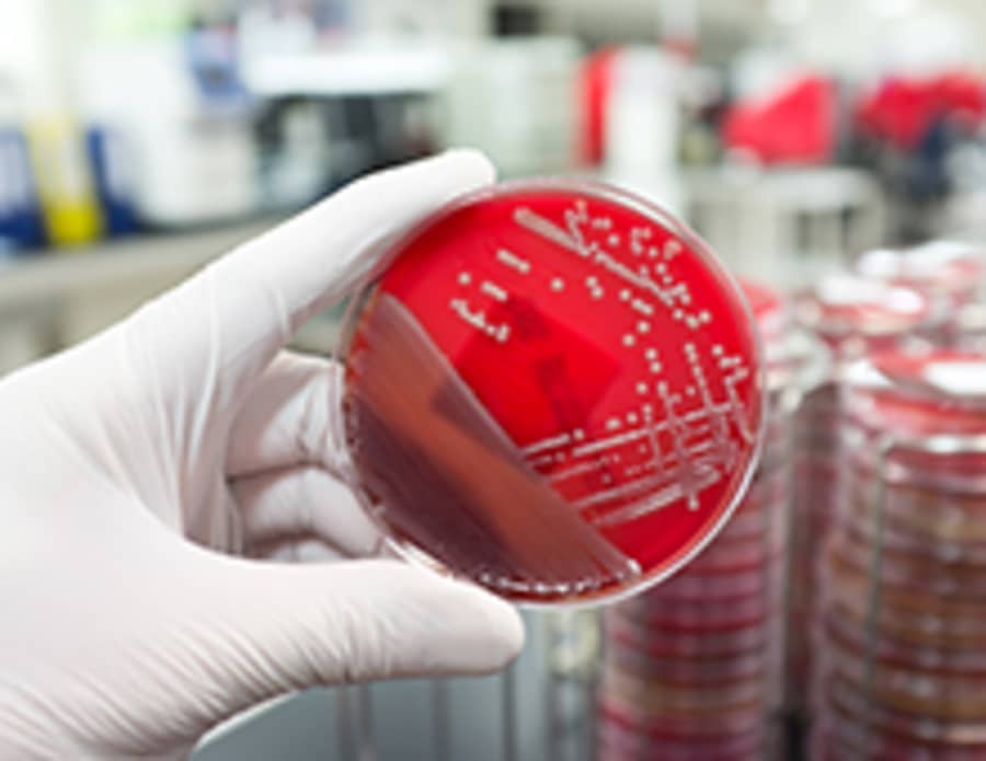 Bacteriegroei in een kweekbakje