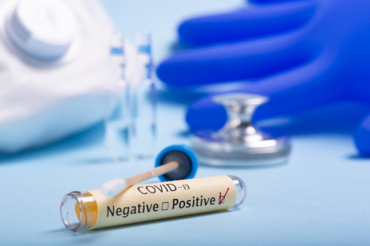 Szybki test diagnostyczny antygen SARS-CoV-2