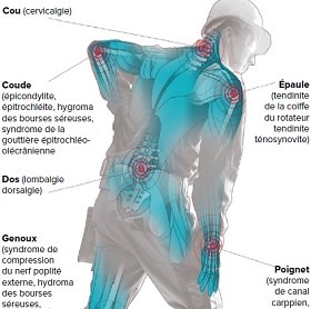 PREVENTIONS DES TROUBLES MUSCULOSQUELETTIQUES