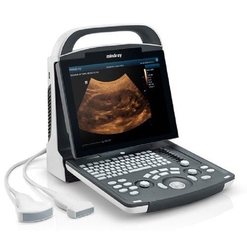 Portable Ultrasound Machine