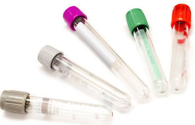 Plastic Test Tubes