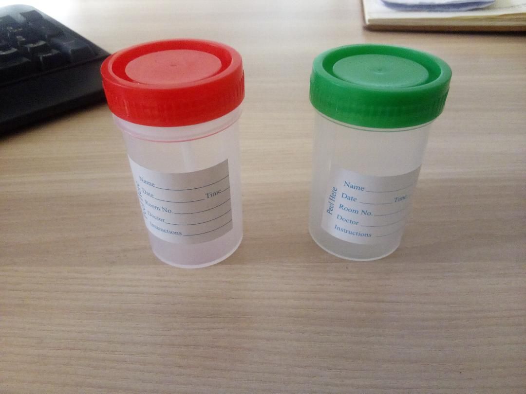 Urine and Stool Containers