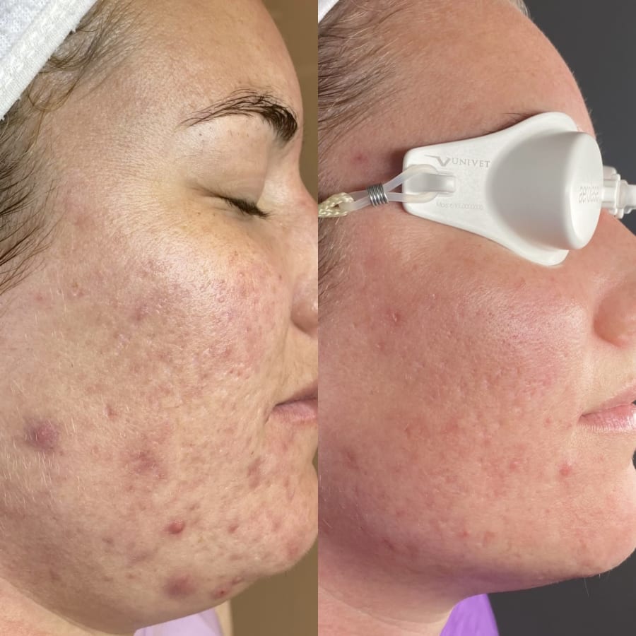 BOUQ Skin – photo 3