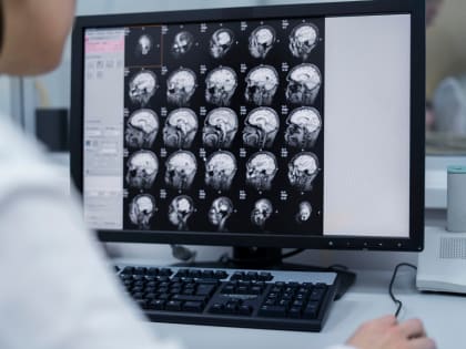 Рентген головы: когда назначается, как проводится и что показывает исследование?