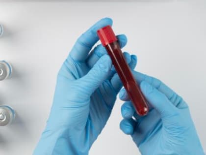 Более 140 вологжан побороли COVID-19 за прошлую неделю