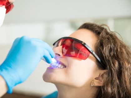 Отбеливание зубной эмали: чем оно отличается от аппаратной чистки и можно ли его проводить самостоятельно?