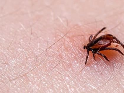 Больше 9 тысяч жителей Вологодчины пострадали от укусов клещей с начала года