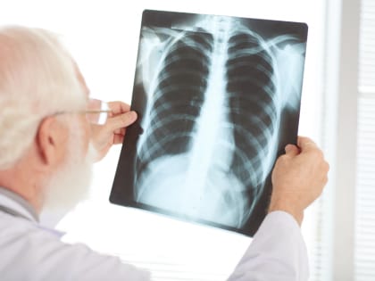 Рентген легких или флюорография? Показания к проведению, особенности исследований и оценка их безвредности