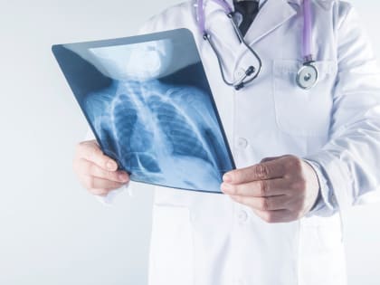 Все, что нужно знать о рентгеновских снимках: процедура получения, оценка вредности диагностики и интерпретация изображений