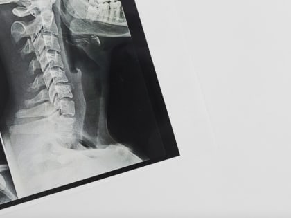 Где можно сделать рентген? Крупнейшие платные диагностические центры страны