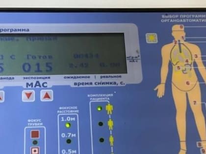 Диагностический аппарат за 5 с половиной млн рублей осваивают в  Харовской  ЦРБ