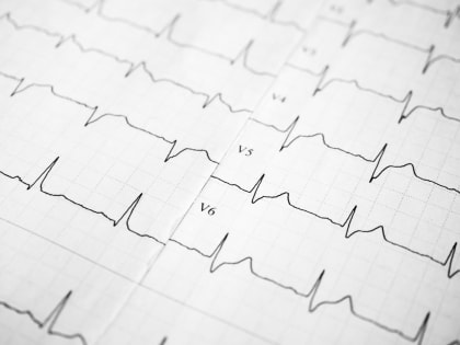 Холтеровское мониторирование – эффективный метод диагностики сердечно-сосудистых заболеваний