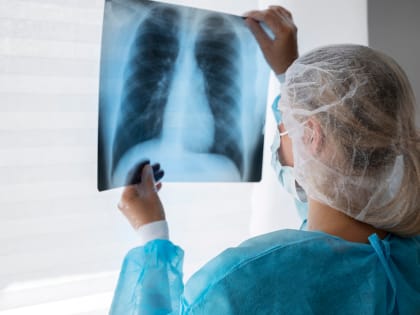 Что показывает рентген грудной клетки, когда может быть назначена процедура и как она проводится?