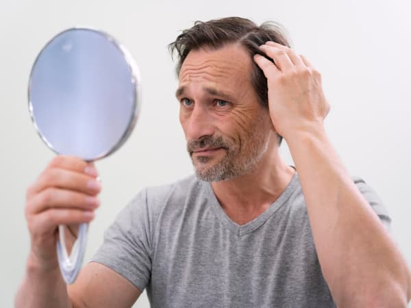 Как остановить выпадение волос у мужчины: эффективные методы и средства