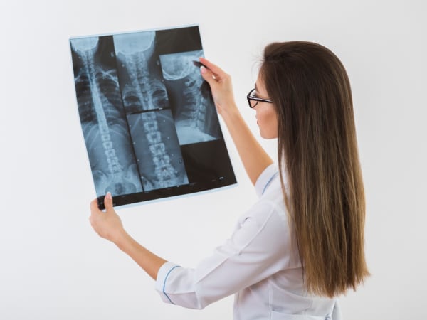 Что нужно знать о рентгене позвоночника?