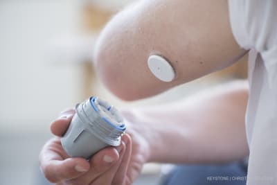 Ein Typ mit Diabetes klebt sich einen FreeStyle Libre Sensor von Abbott Diabetes Care auf den Arm, aufgenommen am 16. Juli 2018 bei ihm zu Hause in Zürich, Schweiz.