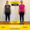 Vorher_Nachher_4