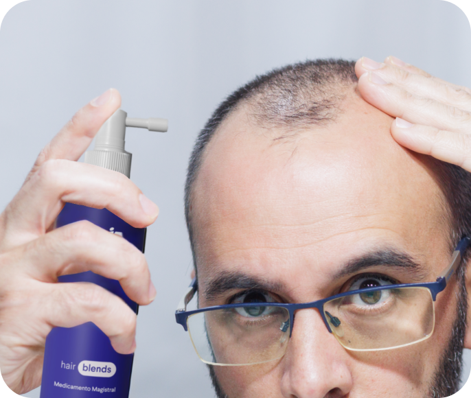 Dutasterida 0.25% + Minoxidil 7% + Tretinoína 0.0125%
